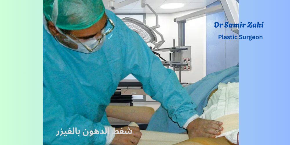 شفط الدهون بالفيزر