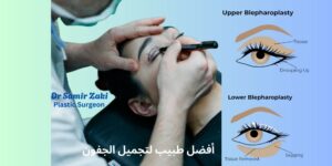 أفضل طبيب تجميل جفون في مصر