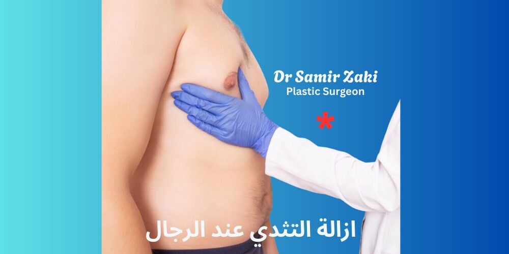 ازالة التثدي عند الرجال